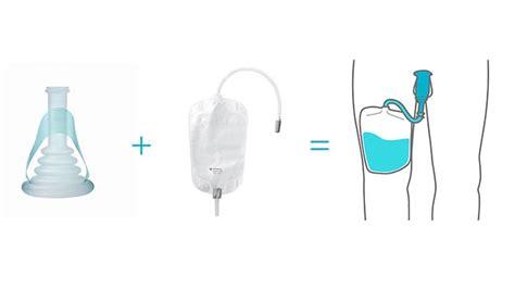uridom menn|How to use a urisheath and uridome catheter .